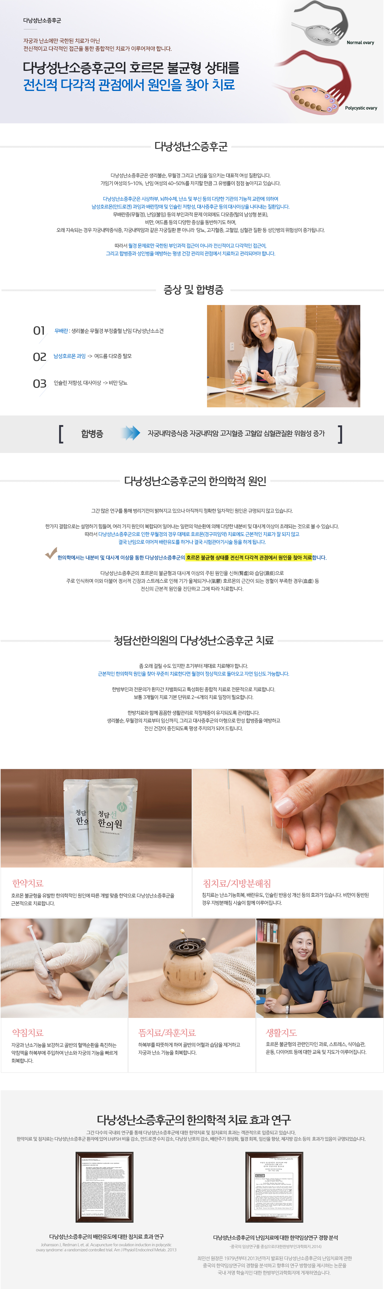 다낭성난소증후군